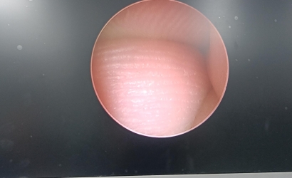 宫腔镜常见故障及排查方法及YOUSHI宫腔一体镜Y2052的维修案例