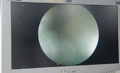 STRYKER关节镜0502-104-030维修案例分析