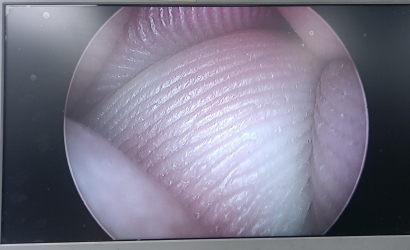 电切镜的介绍及Wolf狼牌电切镜8650.414维修案例分析