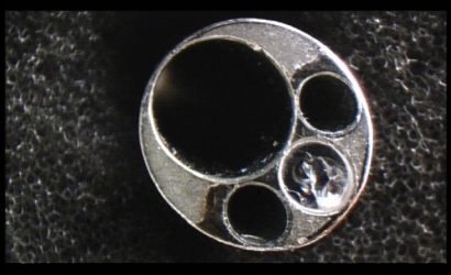 经皮椎间孔镜治疗及提斯joimaxFS63421810椎间孔镜的维修案例