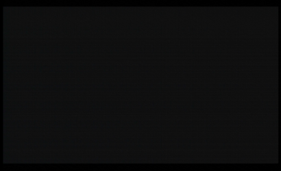 经皮肾镜手术治疗及STORZ经皮肾镜 26092AMA维修案例分析